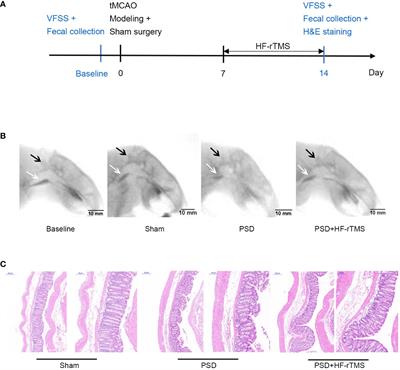 Comprehensive assessment of HF-rTMS treatment mechanism for post-stroke dysphagia in rats by integration of fecal metabolomics and 16S rRNA sequencing